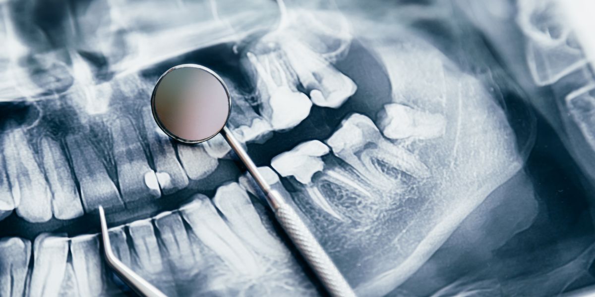 Why Offering a Dental Warranty Can Benefit Your Practice and Patients