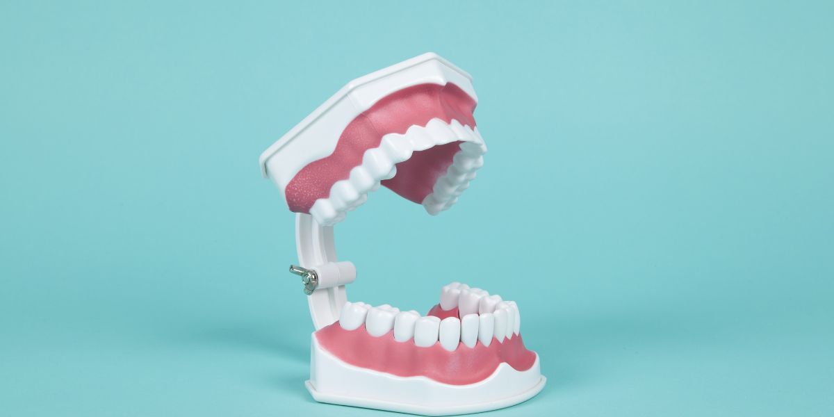 Protect Your Smile Investment with a Dental Warranty