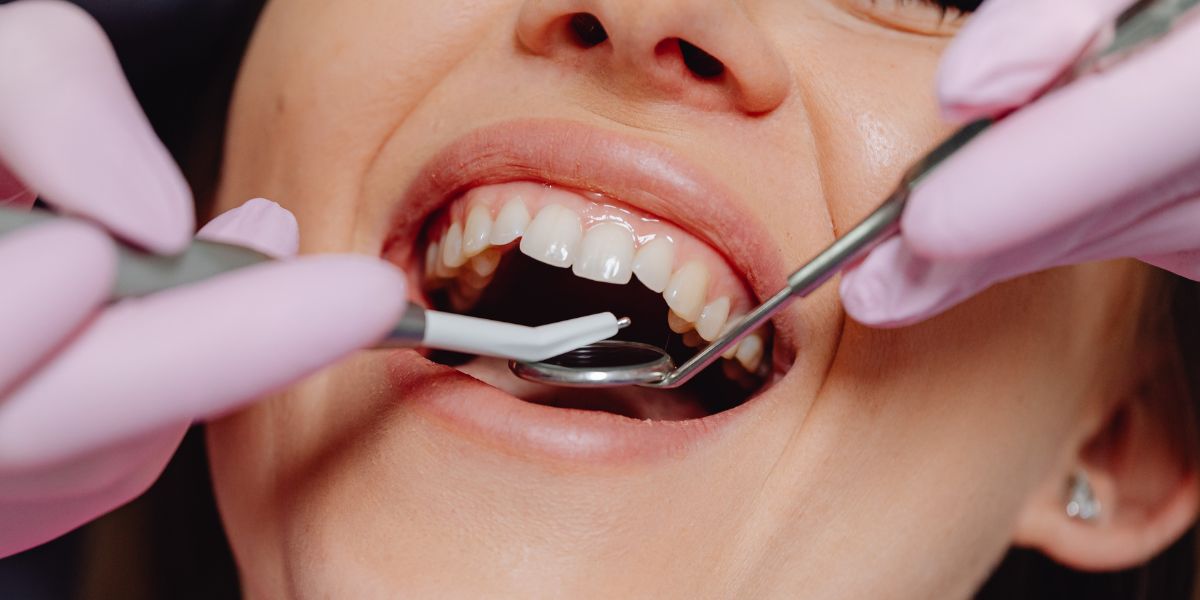 Common Dental Treatments Covered by Warranties