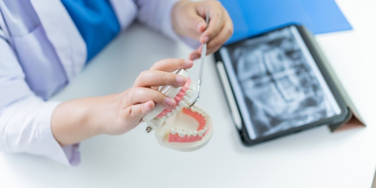 How Long Do Dental Crowns Last, and Should You Get a Warranty